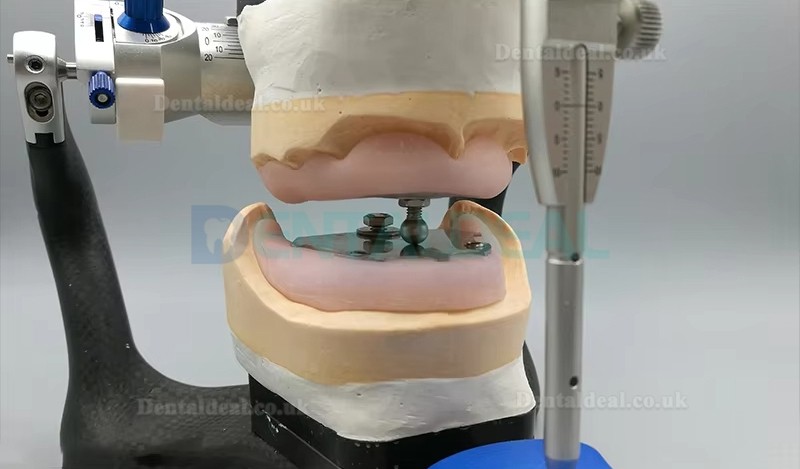 Dental Gothic Arch Tracer for Vertical Centric Recording